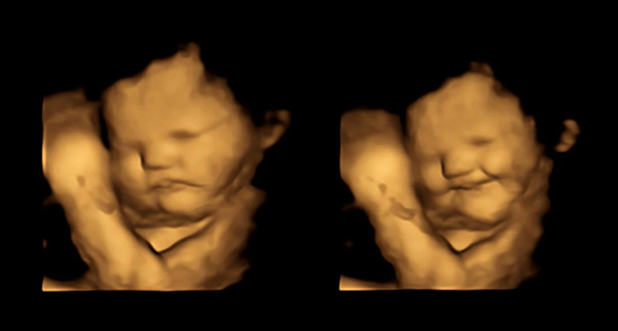 Babys reagieren schon im Mutterleib auf Geschmack