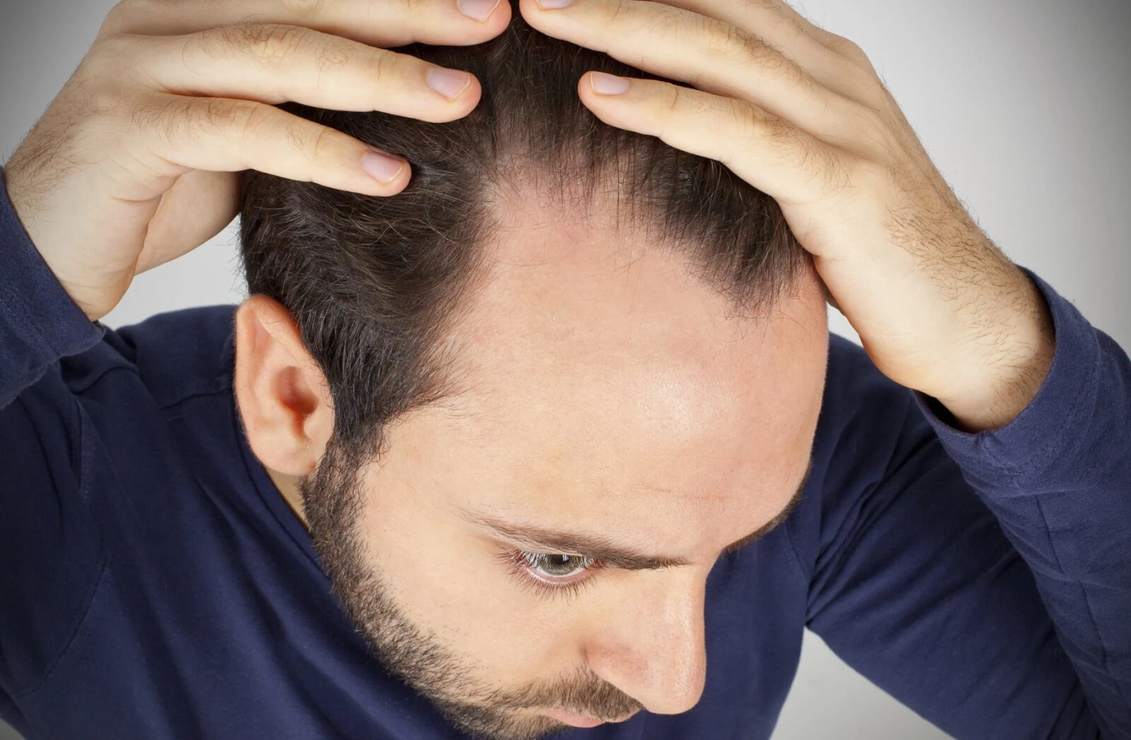 Haargesundheit: So beeinflusst die Psyche den Haarausfall