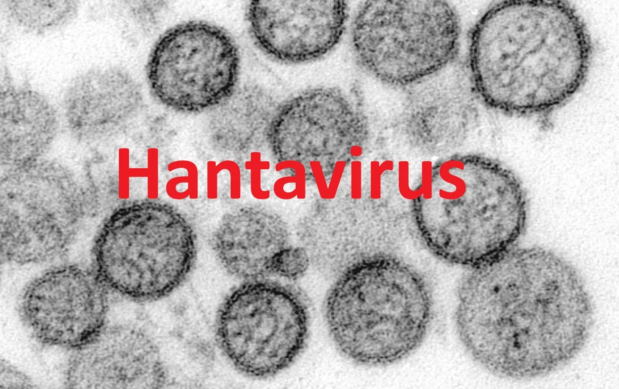 Hantavirus auf einem Kreuzfahrtschiff – Update