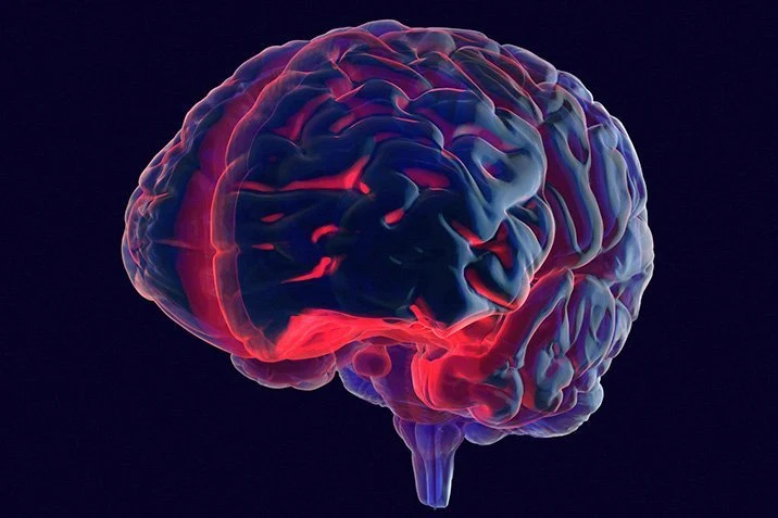 Parkinson: Ist die Immunabwehr schuld?