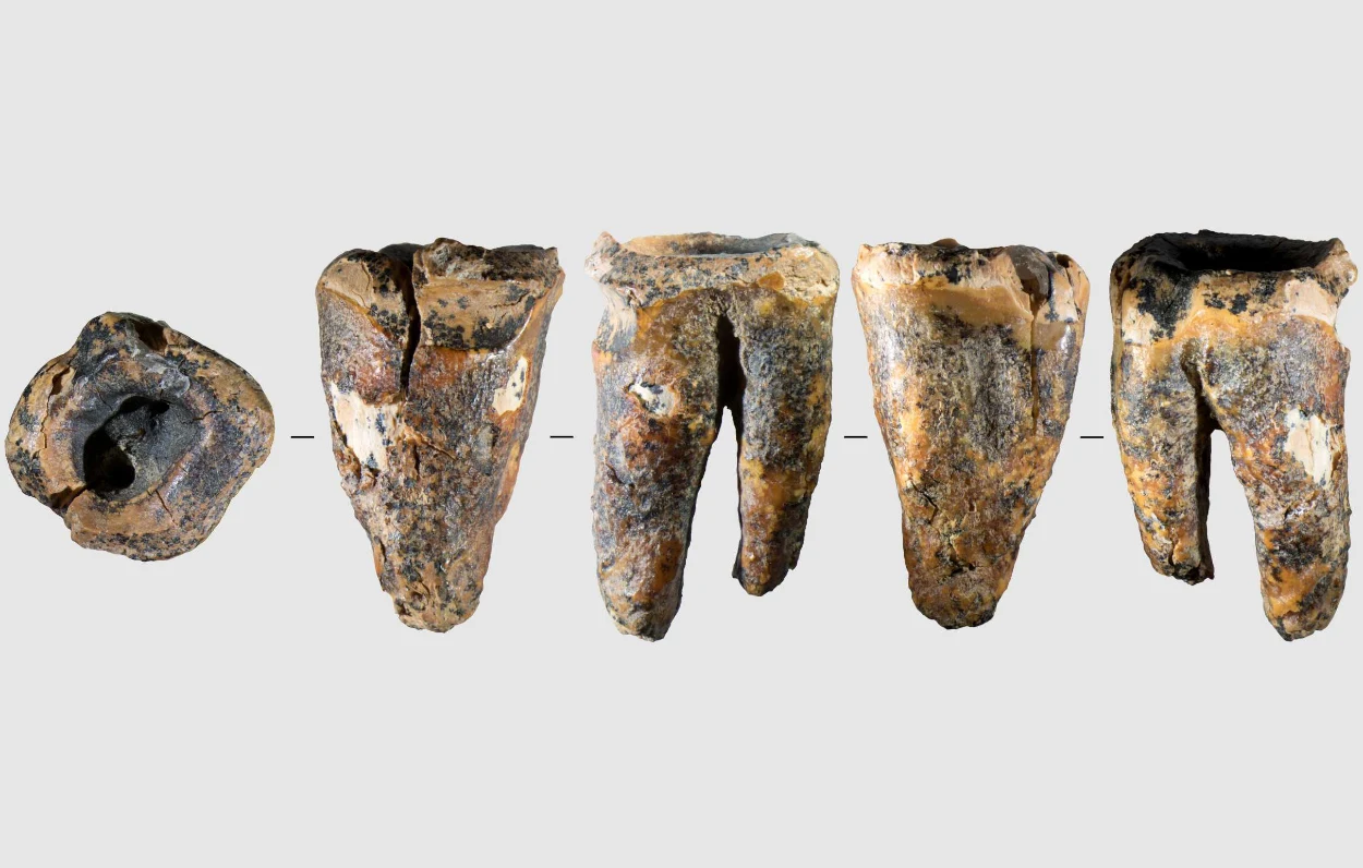 Neandertaler: Mit dem Steinbohrer gegen Karies