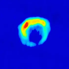 Jugendliche Supernova