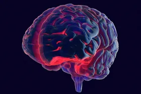Parkinson: Ist die Immunabwehr schuld?