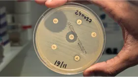 Gefahr durch multiresistenten Cholera-Erreger steigt