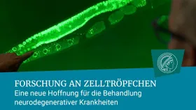 Erstaunliche Zelltröpfchen im Visier