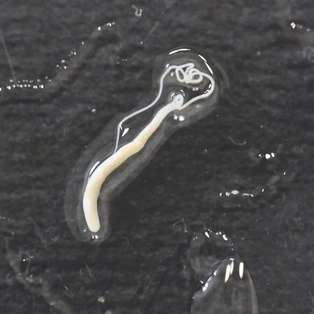 HR_Trichuris_Adult_Photo_Y.Endriss_Swiss_TPH.jpg