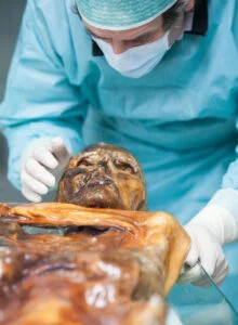 Ötzi
