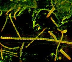 Cyanobakterien verraten Kalziumgehalt urzeitlicher Ozeane