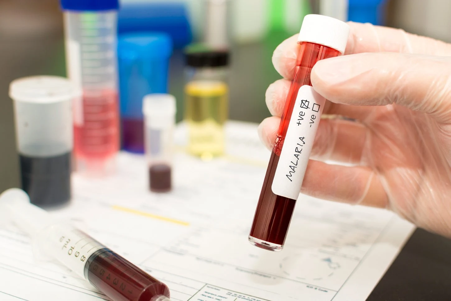 Resistente Malaria-Erreger auf dem Vormarsch