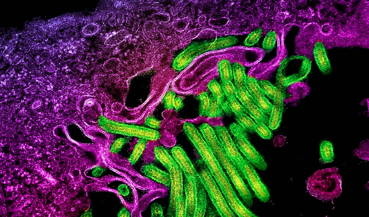 Ebola-Update: Virusgenom sequenziert, Suche nach antiviralen Mitteln läuft