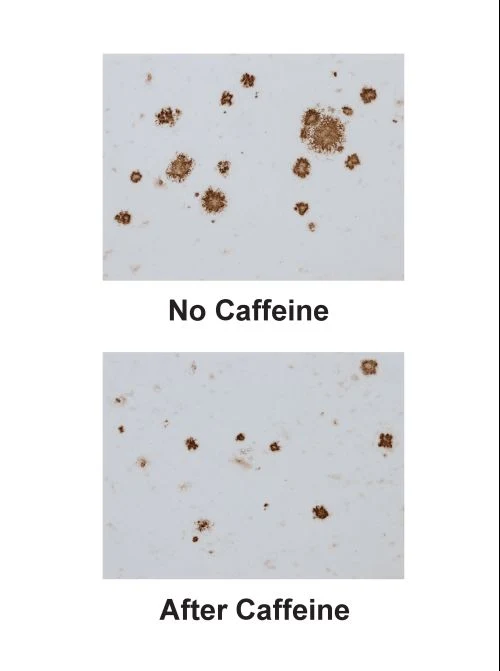 Mit Koffein gegen das Vergessen