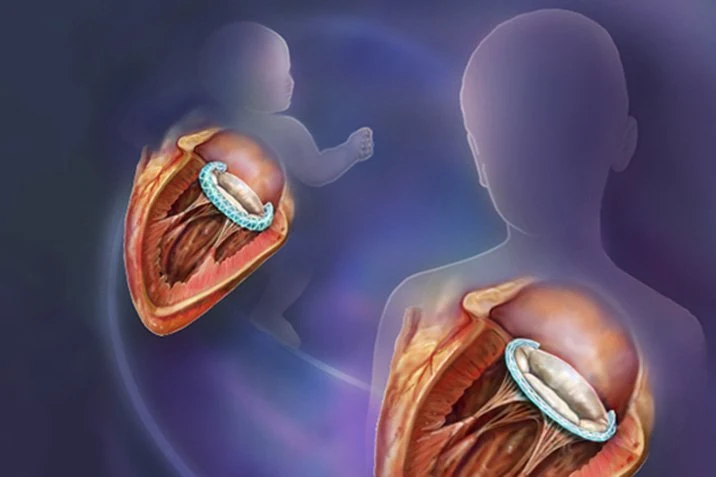 Ein mitwachsendes Implantat