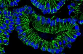 Wie das Immunsystem Sars-CoV-2 nützt