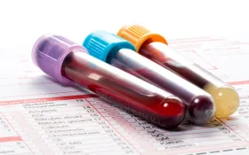 Blut- und Urintest zur Krebsfrüherkennung?