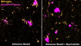 Alternde Nerven-Isolierungen fördern Alzheimer