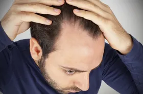 Haargesundheit: So beeinflusst die Psyche den Haarausfall