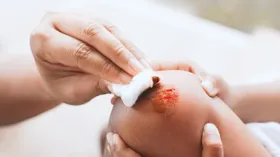 Heilsame Nähe: Kuschelhormon Oxytocin fördert die Wundheilung
