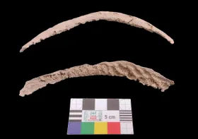 Syphilis-Erreger stammt doch aus Amerika