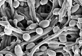 Wie Pilze und Immunsystem im Darm zusammenspielen