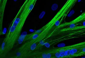 Mit mRNA gegen Muskelschwund