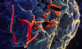 Ebolavirus bleibt nach dem Fieber im Gehirn