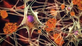 Alzheimer: Wirkstoffe gegen Tau-Fibrillen im Test