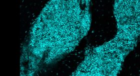 Neuartige Immunstruktur im Schädelknochen entdeckt