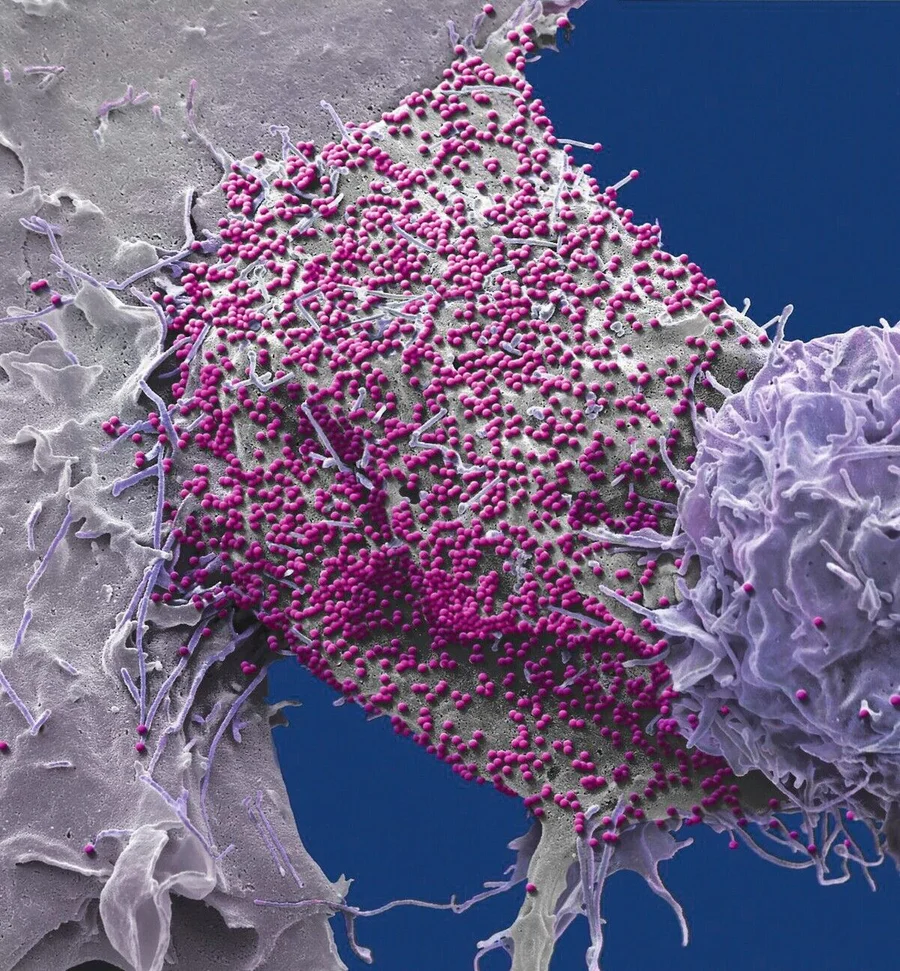 HR_SPL_12489916_HIV_infected_cell_SEM.jpg