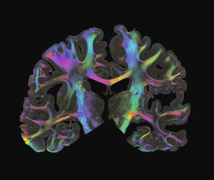 xFiberOrientationMap_HumanBrain_Forschungszentrum_Juelich.jpg