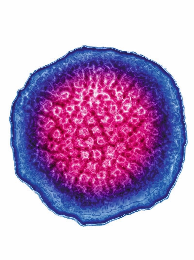 HR_SPL_12045391_Epstein_Barr_Virus_HSV4.jpg
