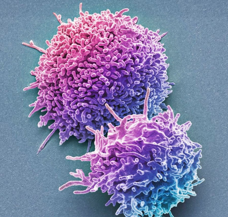 Natural_killer_(NK)_cell,_SEM