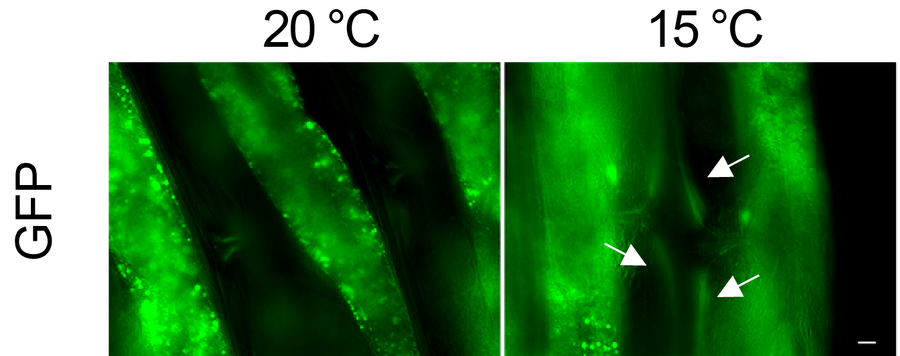 C. elegans Muskeln, markiert mit GFP