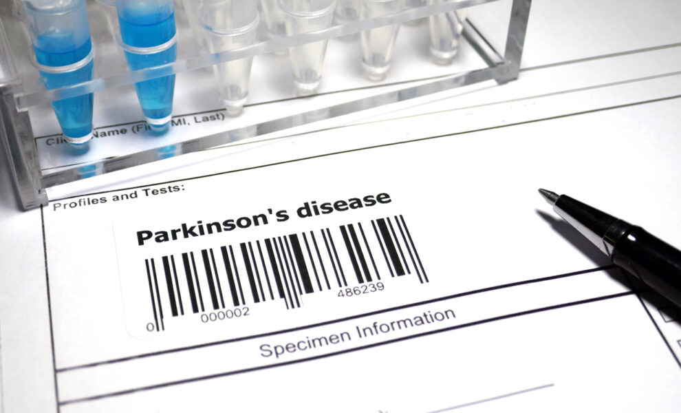 Early detection of Parkinson’s with stool samples?