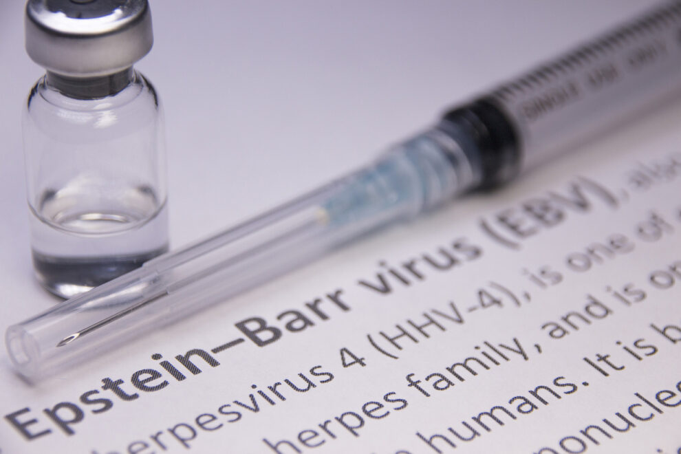 Vaccine against Epstein-Barr virus?