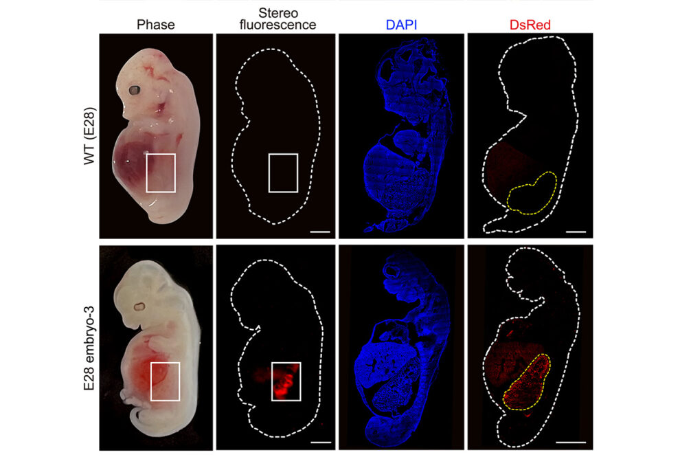 Embryonic human kidneys grown in pigs