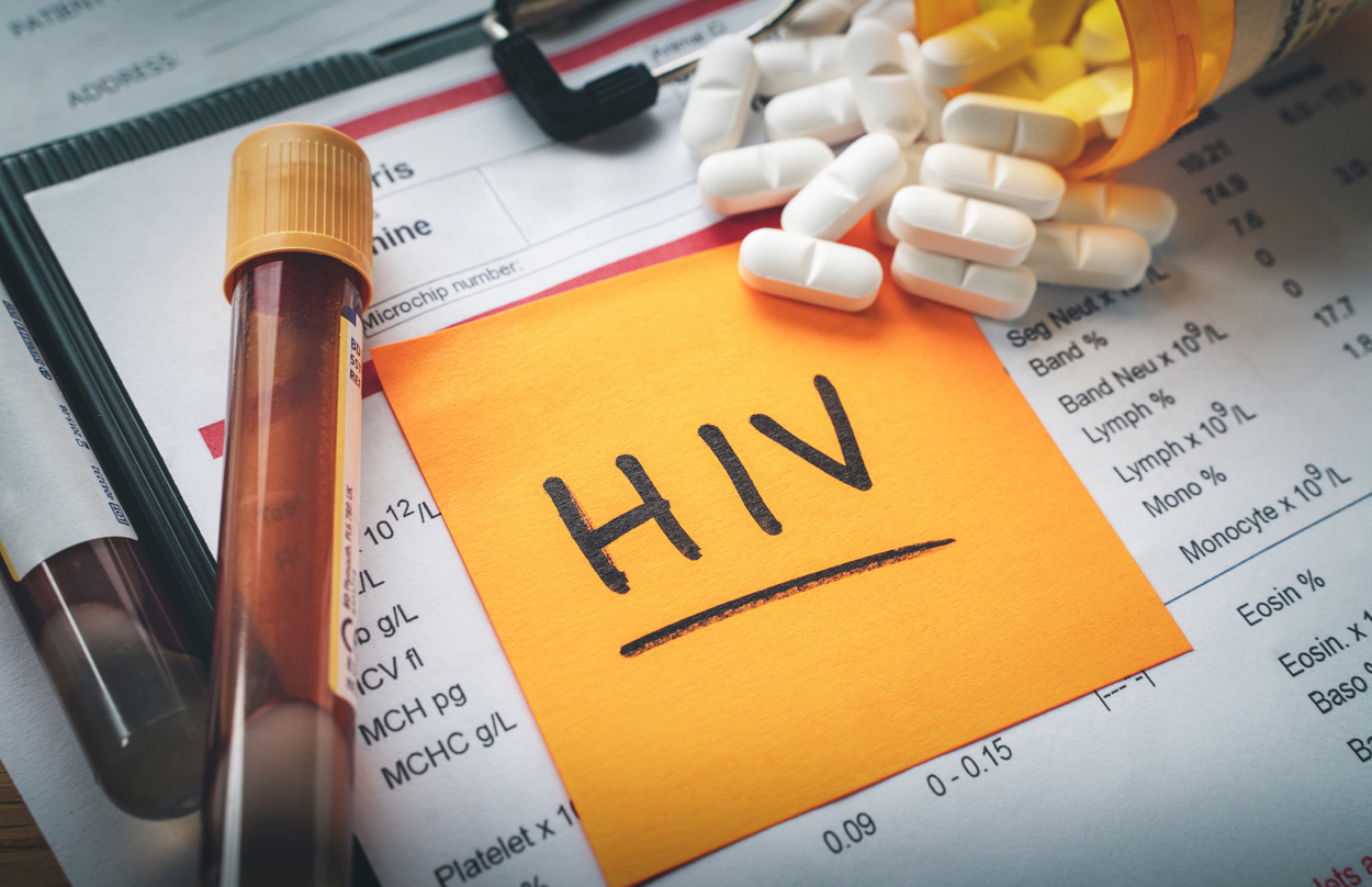 #Erster Schritt zur Impfung gegen HIV?