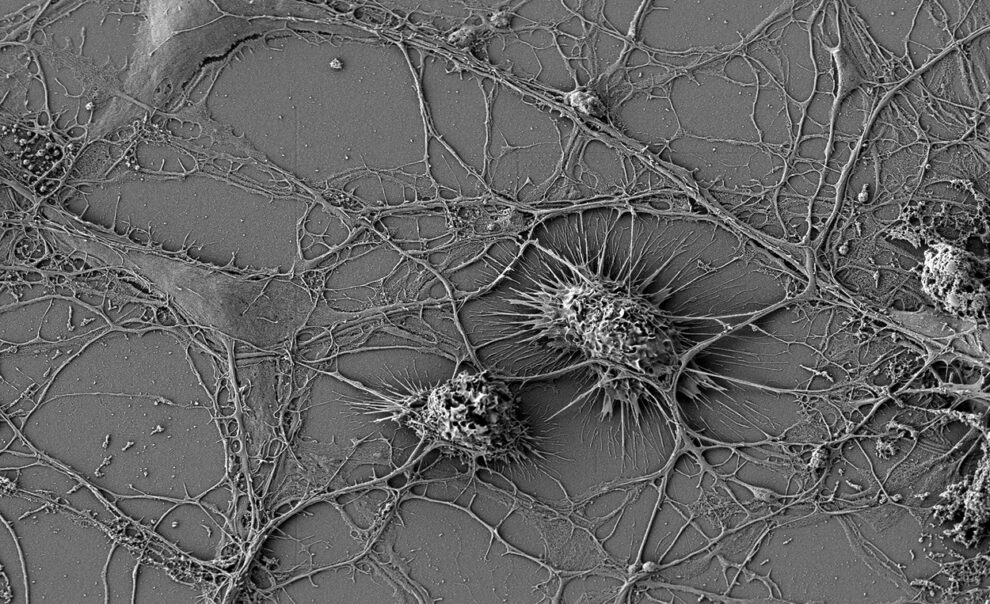 Mikroglia und Neuronen