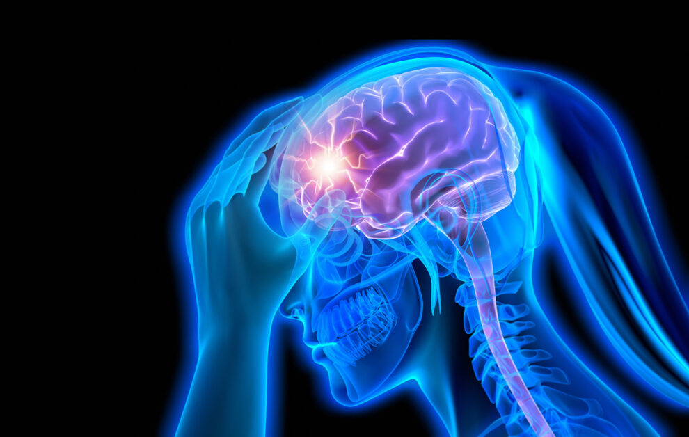 Migraine medications in comparison test