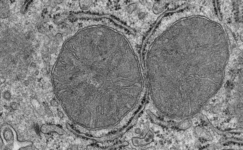 Electron micrograph of mitochondria in liver cells