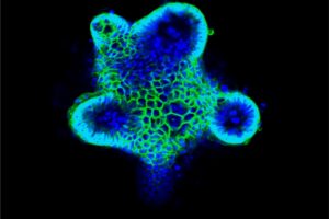 Ein Organoid, das die biologischen Eigenschaften des menschlichen Darmes hat.