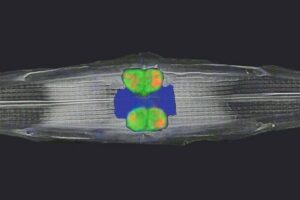 Tschitschko_et_al_symbiont_diatom_M.jpg