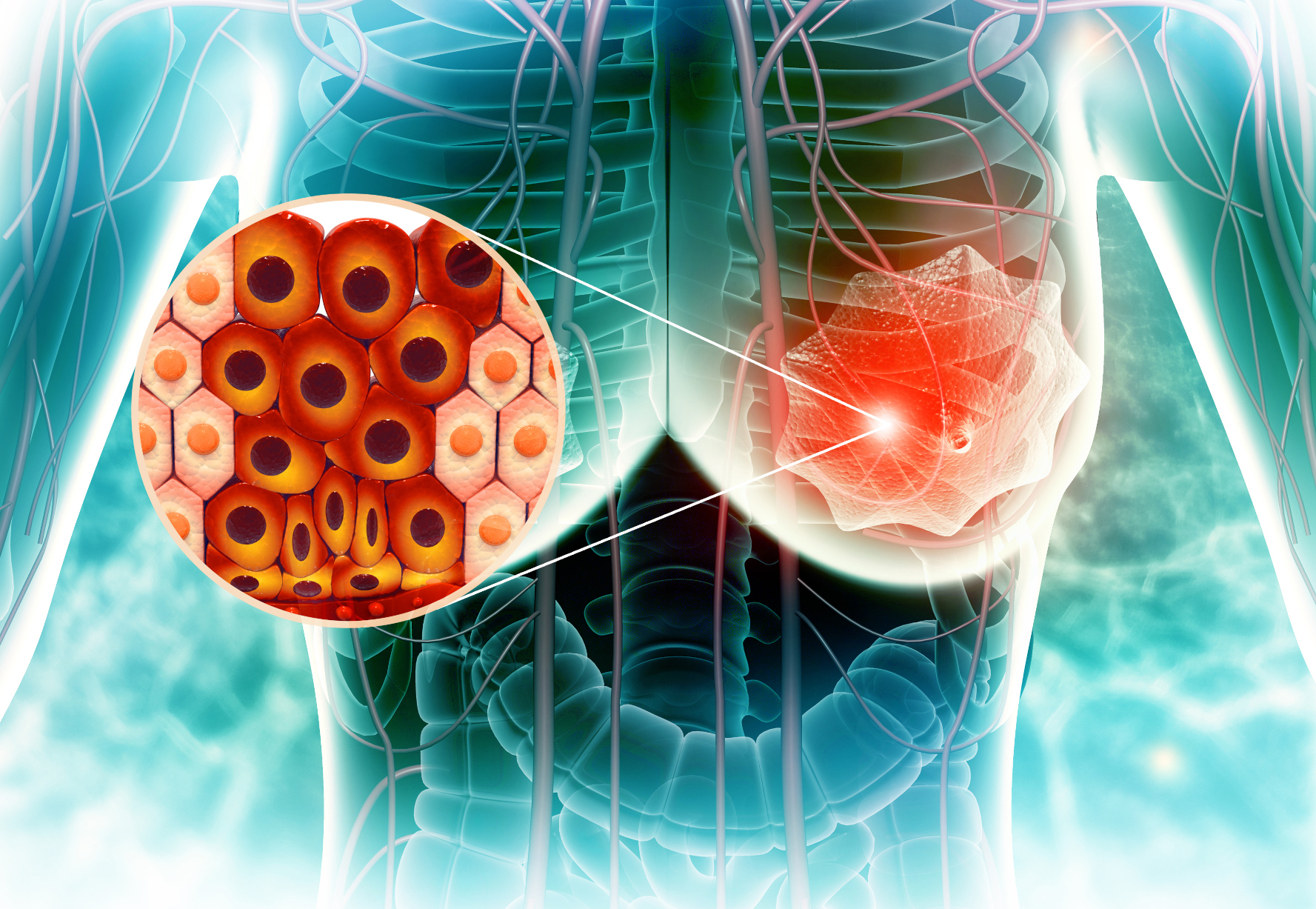 #Tumore machen Fettzellen zu „Komplizen“