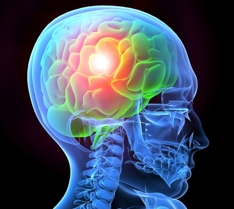 Traumatic Brain Injury Definition Psychology